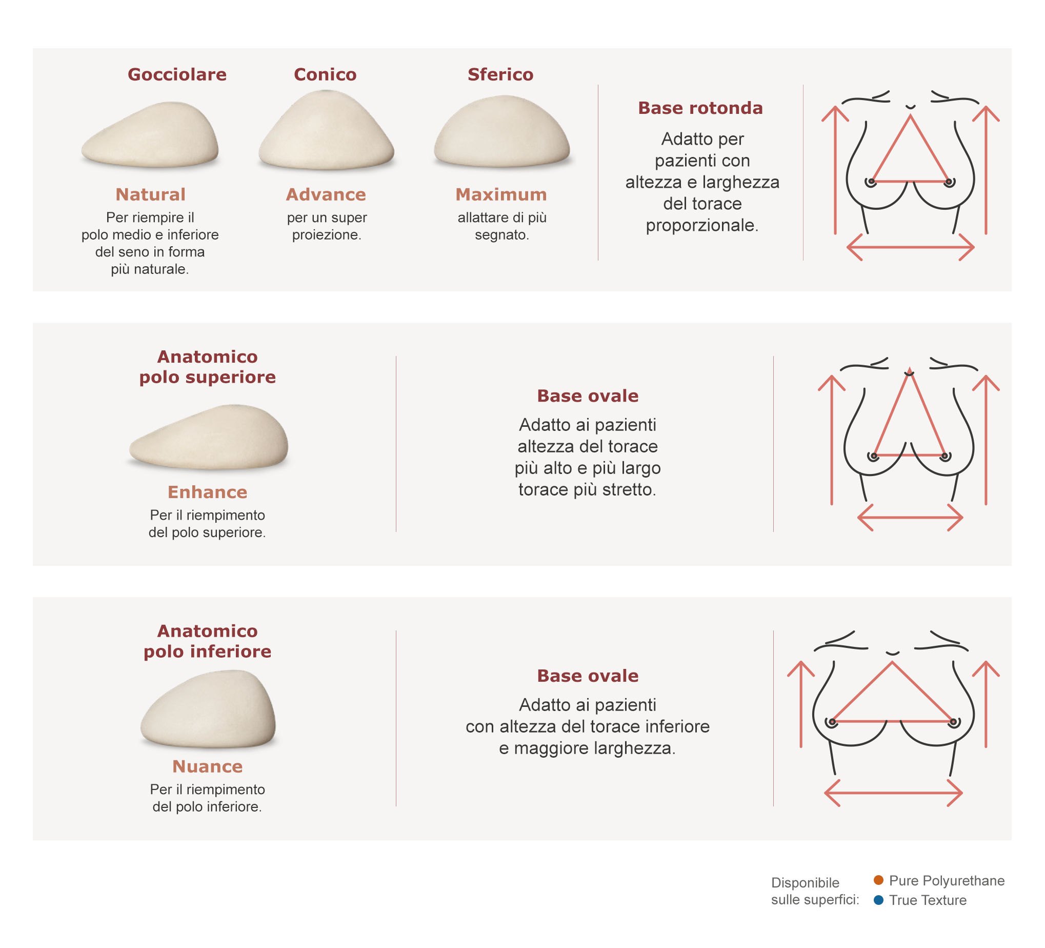 Esistono cinque tipi di impianti con profili e basi diversi