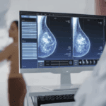 ¿Es posible la mamografía con silicona?